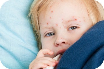 can dogs catch chickenpox from humans